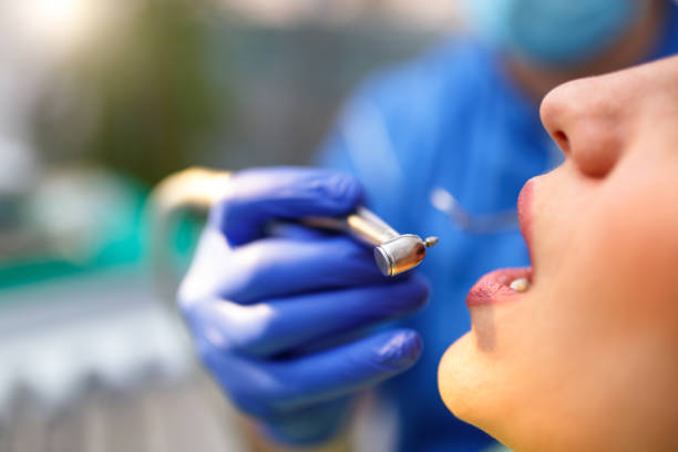 Dental Inlays and Onlays in Pulaski, NY